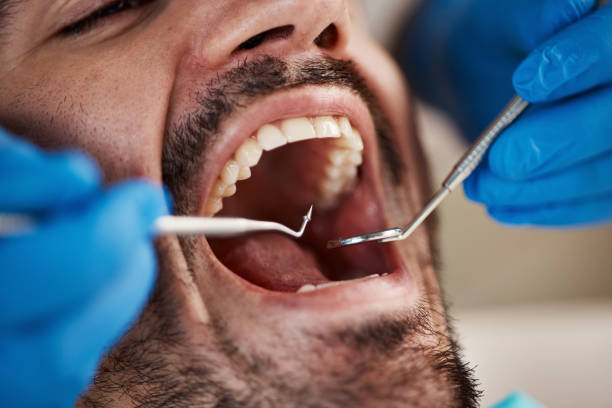 Best Knocked-Out Tooth Emergency  in Palmview South, TX