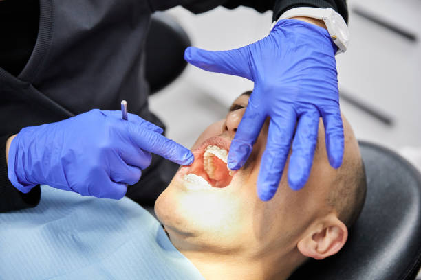 Best Chipped Tooth Repair Near Me  in Palmview South, TX