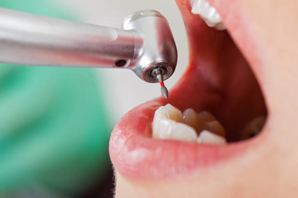 Best Broken Tooth Emergency  in Palmview South, TX